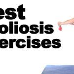 10 Best Scoliosis Exercises - Ask Doctor Jo