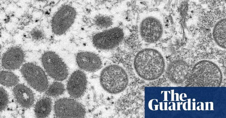 Monkeypox could significantly disrupt UK sexual health services, expert says | Monkeypox | The Guardian