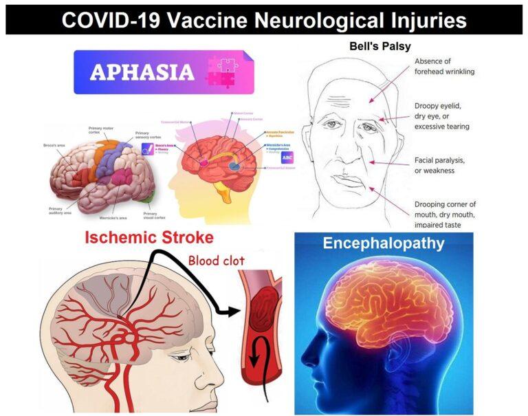 A Brain-Damaged Nation: Neurological Diseases Explode in 2021 After COVID-19 Vaccines – 100,000%+ Increase in Strokes