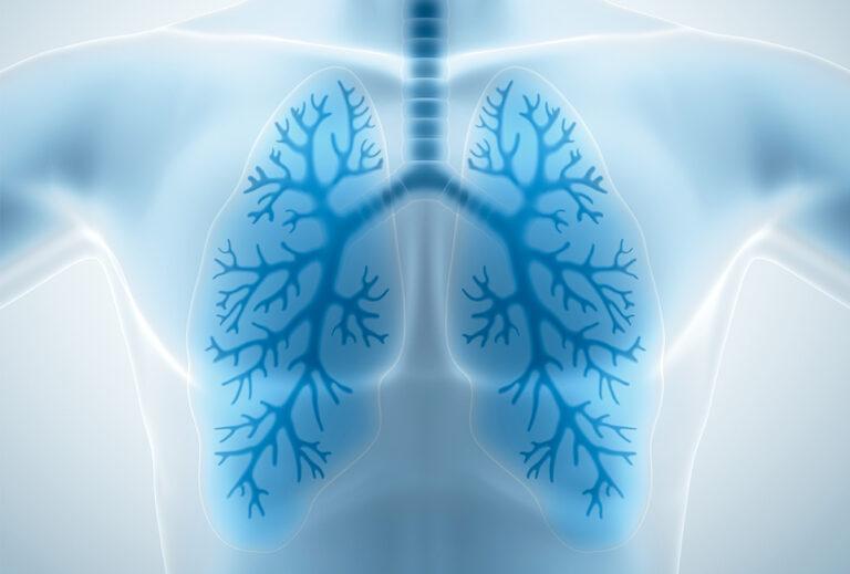 Starts Tomorrow: 44 Things You NEVER Knew About Lung Health [FREE Summit] | Holistic Health Online