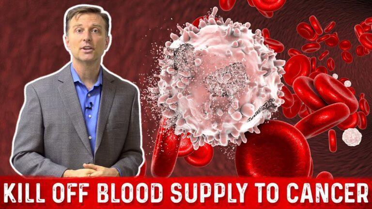 Foods that Cut off the Blood Supply to Cancer Cells & Anti Angiogenesis – Dr. Berg