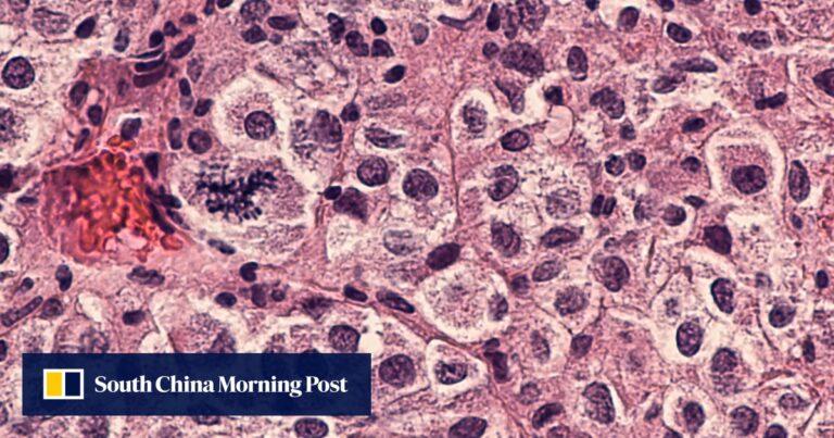 Moderna’s personalised mRNA cancer vaccine shows promise for next phase of trials | South China Morning Post