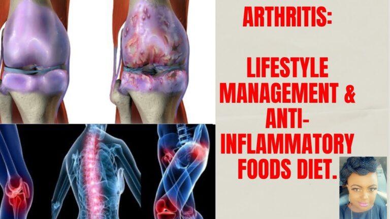 Arthritis management with anti-inflammatory diet, exercise, and weight management. osteo—rheumatoid.