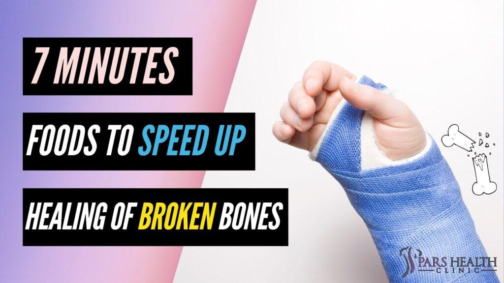 Eat These Foods to Speed up Healing of Broken Bones
