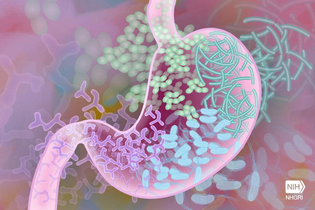 Antibiotics given in infancy may have adverse impact on adult gut health
