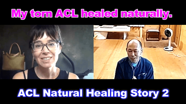 Natural Healing of a Complete ACL Tear – Case 21