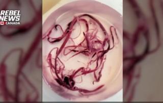 https://healthimpactnews.com/wp-content/uploads/sites/2/2023/04/strange-clots-rebel-news-320x202.jpg