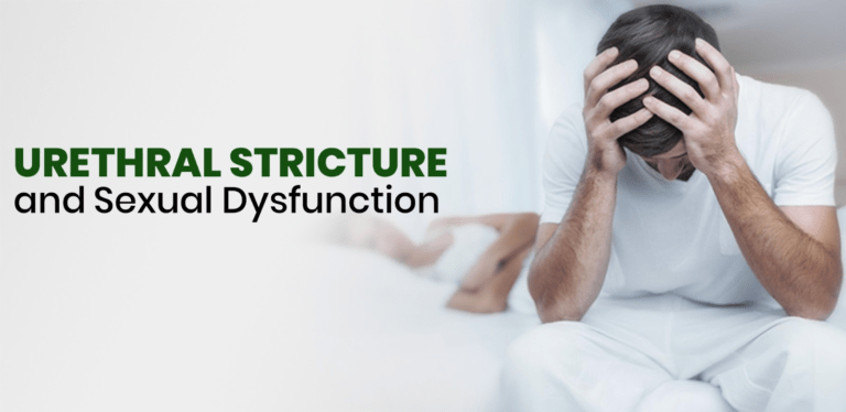 How Urethral Stricture Affects Your Sexual Health