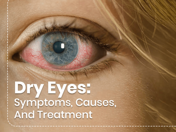Dry Eyes Natural Cure: Relief Your Sore And Irritated Eyes! %