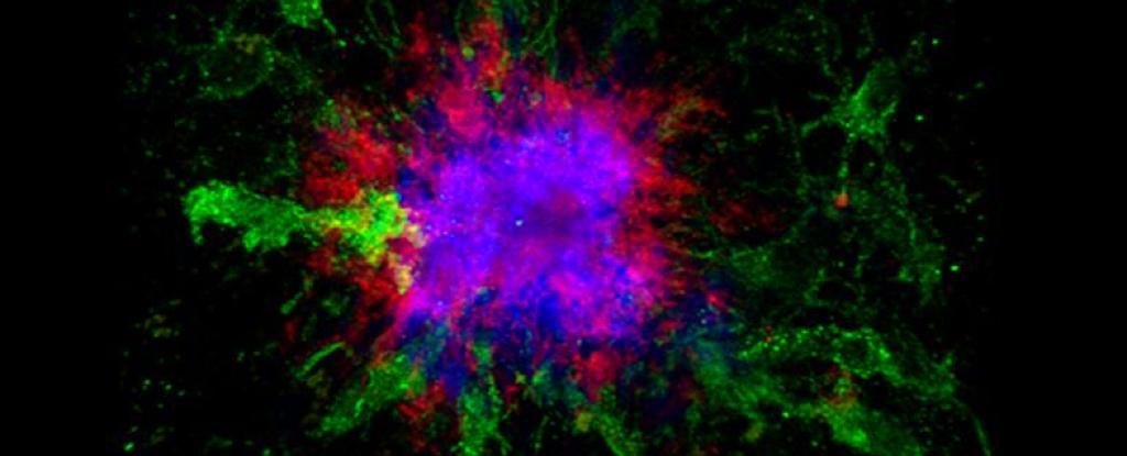 Intermittent Fasting May Help Slow Alzheimer's, Scientists Say : ScienceAlert