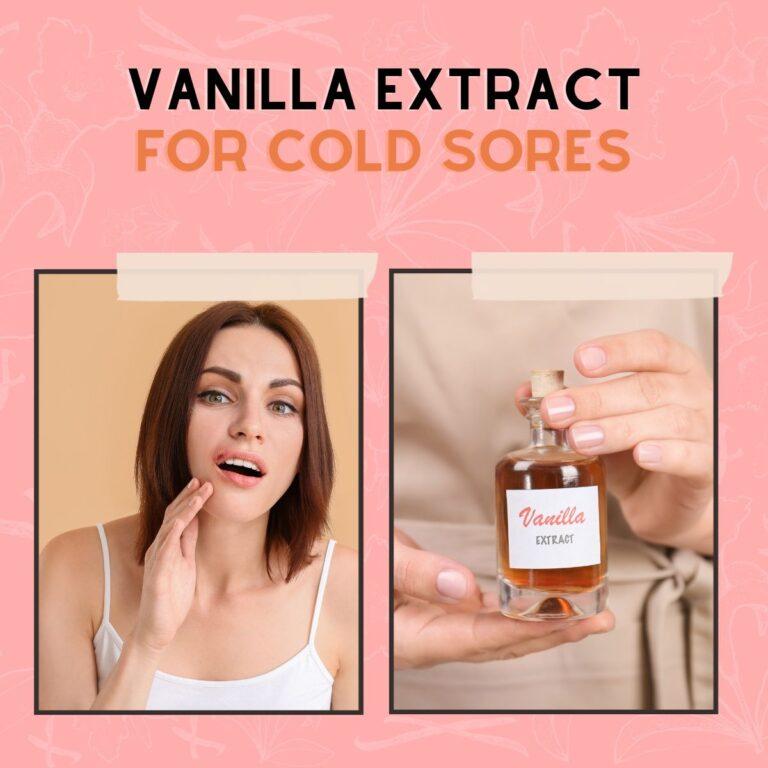 Natural Healing Power Of Vanilla Extract For Cold Sores