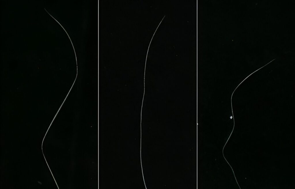 Molecular secrets behind 'zigzag' hair patterns uncovered, offering an avenue for anti-aging solutions
