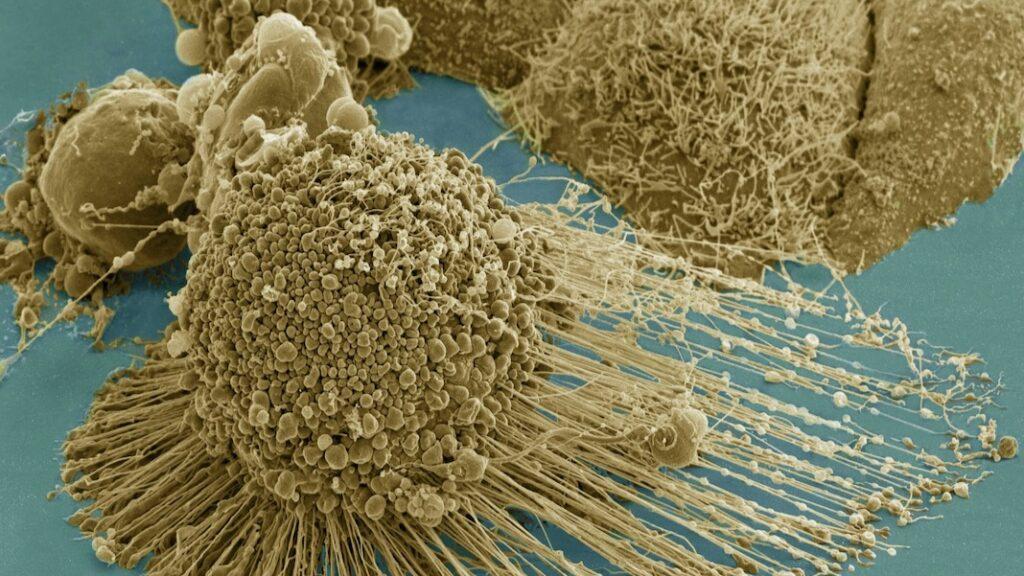Zombie Cells Have a Weakness. An Experimental Anti-Aging Therapy Exploits It.