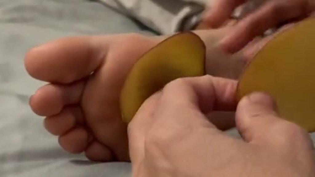 Health coach mom is slammed by critics after revealing the all-natural remedies she uses to treat her teen daughter's cold - from covering her throat in iodine to putting POTATOES in her socks | Daily Mail Online