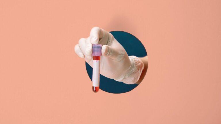 What if a Blood Test Could Predict MS Worsening?