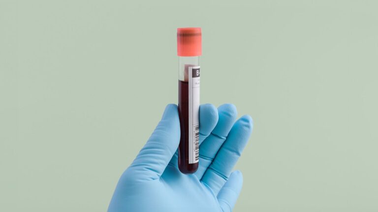 This Blood Test Is Over 90 Percent Accurate in Diagnosing Alzheimer’s Disease