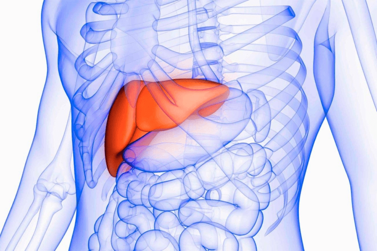 Understanding Fatty Liver Disease: Causes, Symptoms, and Prevention