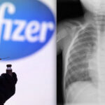SCANDALl! Pfizer Knew very Soon that its Covid mRNA Vaccine caused Heart Damage on Kids. But has Used them as Guinea-Pig
