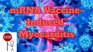 mRNA Vaccine-Induced Myocarditis