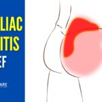 How to Instantly Relieve Arthritic Sacroiliac Joint Pain